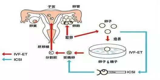 正规捐卵助孕中心有哪些